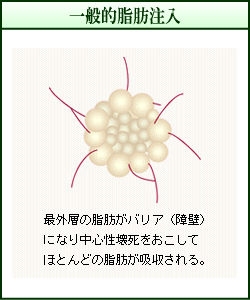 ʓIbiC[Wj