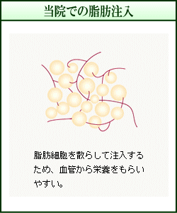 @ł̎biC[Wj