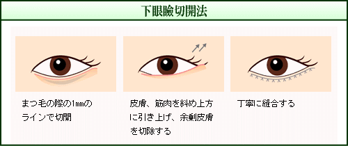 ِ؊J@