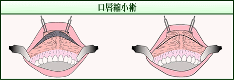 OkpiC[Wj