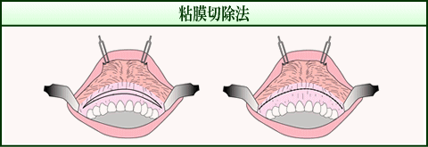 S؏@iC[Wj