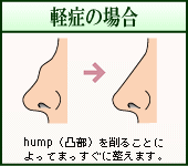 yǂ̏ꍇiC[Wj