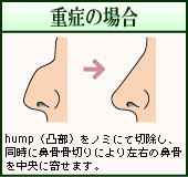 dǂ̏ꍇiC[Wj